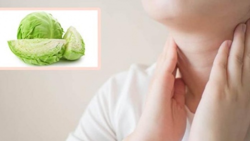 Bị bướu cổ lành tính có nên ăn rau cải bắp?