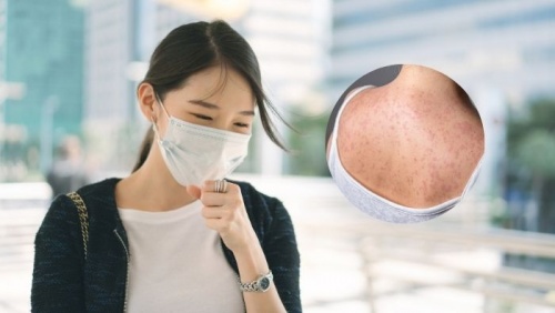 Người lớn cũng bị sởi: Bà bầu cần lưu ý gì?