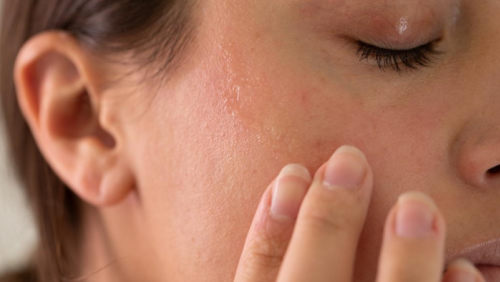 5 nguyên nhân khiến da vẫn khô dù dưỡng ẩm thường xuyên