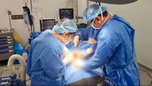 Chướng bụng nhẹ, người phụ nữ phát hiện khối u đầu tụy 12-13cm