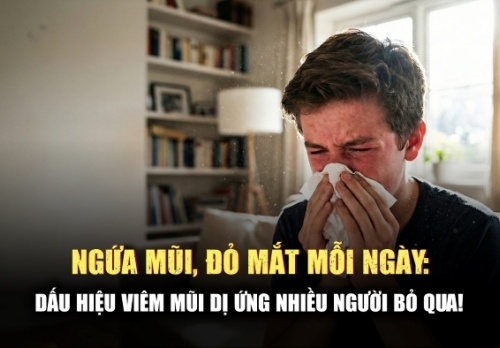 Hắt xì hơi liên tục, ngứa mắt: Có phải viêm mũi dị ứng?