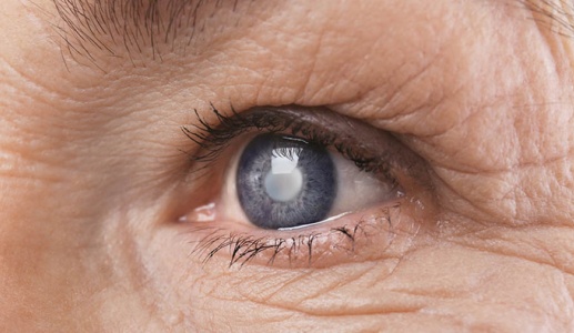Bệnh võng mạc đái tháo đường: Biến chứng mắt nguy hiểm không nên coi thường