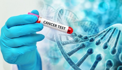 Tầm soát nhiều bệnh ung thư bằng một lần xét nghiệm: Những điều chưa chắc chắn
