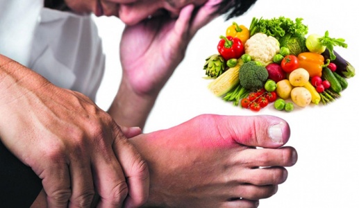 Người bị gout nên ăn và kiêng gì để đẩy lùi bệnh?