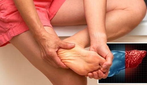 Dấu hiệu ở bàn chân cho thấy vấn đề về gan