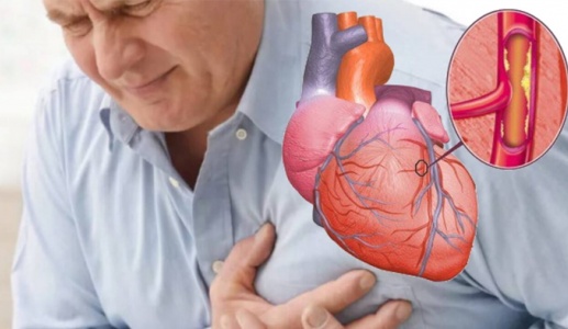 Bị thiếu máu cơ tim có thể sống được bao lâu? 