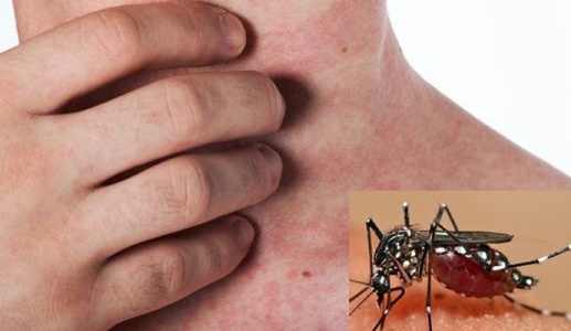 Hiện tượng El Nino có thể làm gia tăng dịch bệnh do muỗi truyền