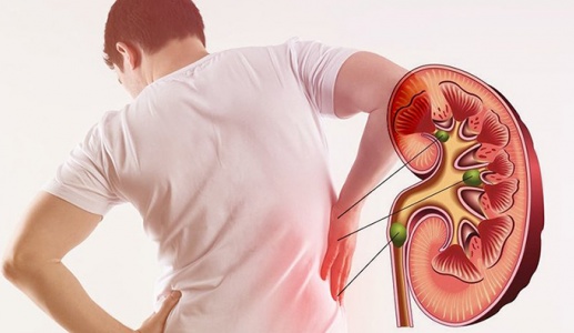 Dấu hiệu cảnh báo suy giảm chức năng thận