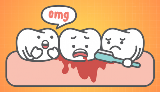 5 lý do dẫn đến chảy máu chân răng