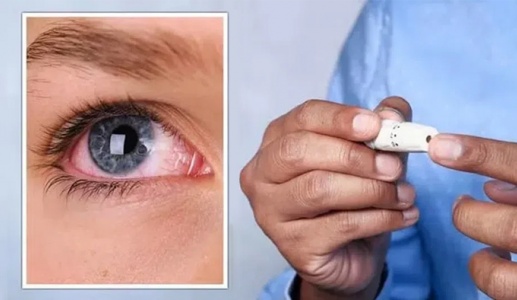 Bị mờ mắt khi mới mắc đái tháo đường, có hồi phục được không?