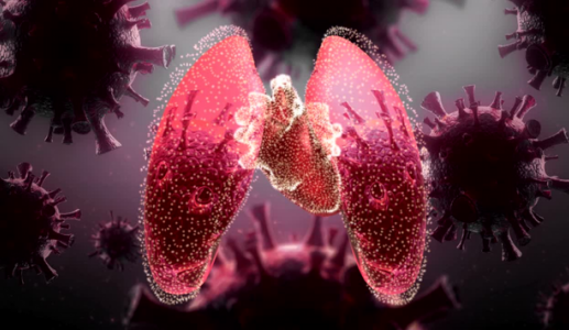 Ung thư phổi giai đoạn 3 sống được bao lâu?