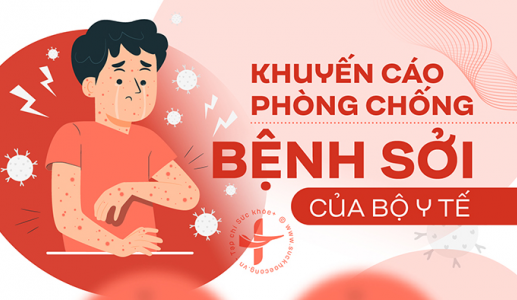 5 việc nên làm để phòng ngừa bệnh sởi