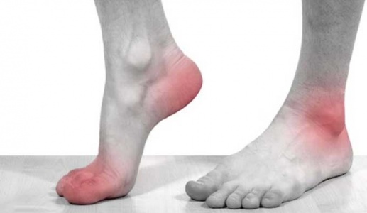 Triệu chứng cảnh báo bệnh gout và giải pháp cải thiện hiệu quả