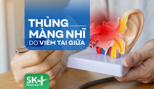 Podcast: Thủng màng nhĩ do viêm tai giữa
