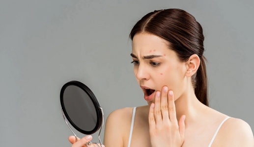 Da nổi mụn có thể do những thực phẩm chức năng này