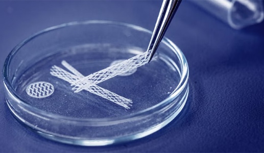 Người bệnh tim có thể đặt tối đa bao nhiêu stent?
