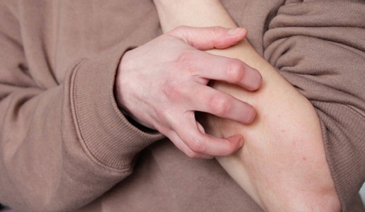 Làm thế nào để giảm ngứa do mề đay mạn tính hiệu quả? 