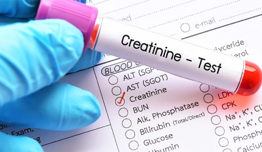 Chỉ số creatinin tăng có phải bị biến chứng thận do đái tháo đường?