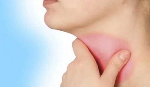 Mẹo cải thiện viêm thanh quản tại nhà hiệu quả