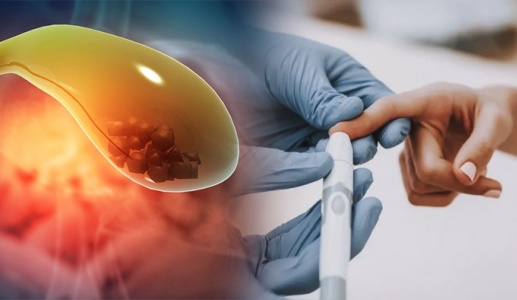 Sỏi bùn túi mật kèm đái tháo đường dùng TPBVSK Kim Đởm Khang được không?