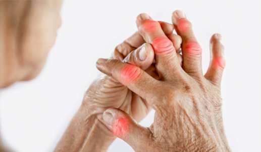 7 loại quả tốt cho người bệnh thấp khớp 