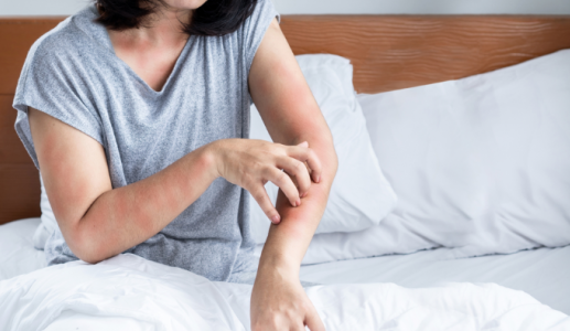 Mối liên hệ giữa viêm da dị ứng và rối loạn giấc ngủ 