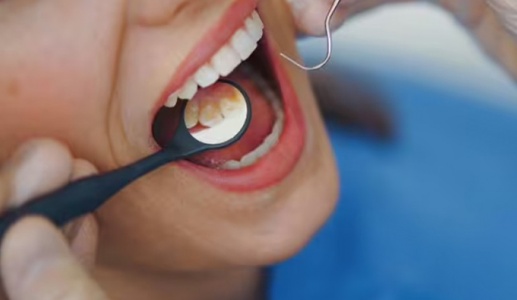 Dấu hiệu ở miệng có thể cảnh báo bệnh tim