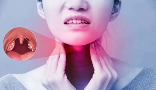 Viêm họng bao lâu thì khỏi?