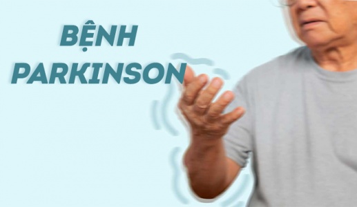 10 dấu hiệu cảnh báo sớm bệnh Parkinson