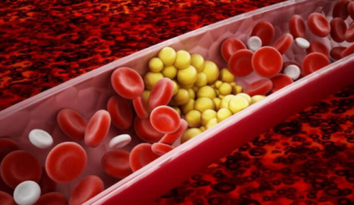 'Điểm danh' những loại quả quen thuộc giúp làm giảm cholesterol