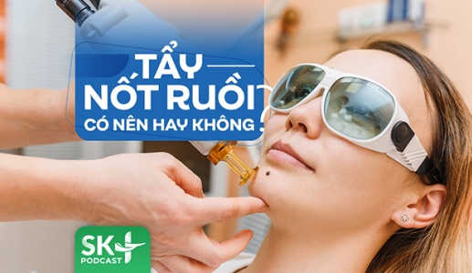 Podcast: Tẩy nốt ruồi có nên hay không?