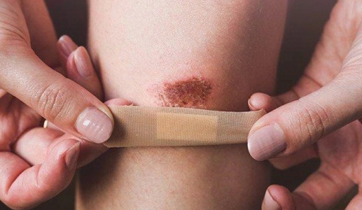 Dấu hiệu cảnh báo cơ thể bạn thiếu kẽm 