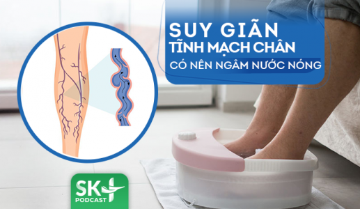 Podcast: Suy giãn tĩnh mạch chân có nên ngâm nước nóng?