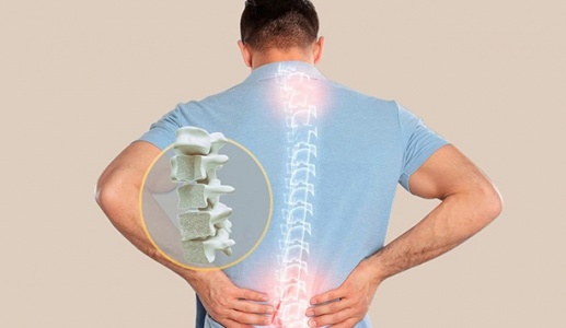 Ứng dụng công nghệ sinh học trong điều trị loãng xương mức độ nặng