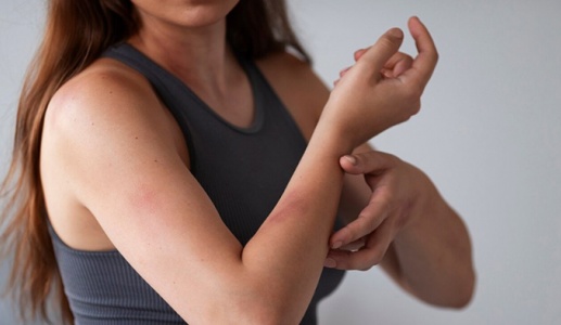 Mẹo xử lý phát ban da do quần áo ẩm ướt