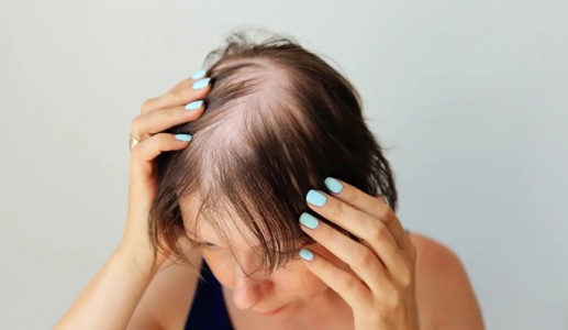 Mách bạn 5 cách giảm rụng tóc hiệu quả