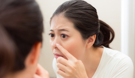 Vì sao không nên nặn mụn trong vùng “tam giác tử thần”?