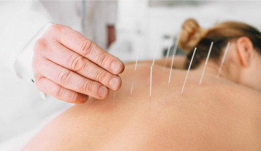 Châm cứu giảm đau: Cách thức hoạt động và những điều cần lưu ý