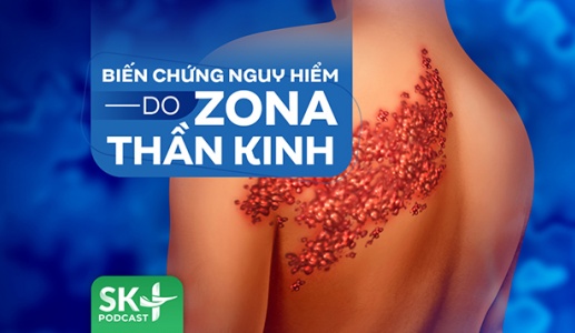 Podcast: Biến chứng nguy hiểm do Zona thần kinh