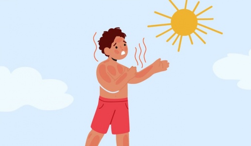Có những cách nào để làn da cháy nắng phục hồi nhanh hơn? 