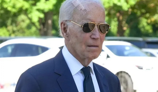 Cựu Tổng thống Mỹ Joe Biden phẫu thuật ung thư da