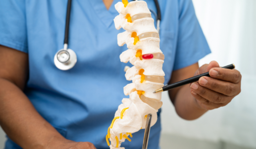 Không chủ quan khi thoát vị đĩa đệm L4 L5 chèn ép dây thần kinh