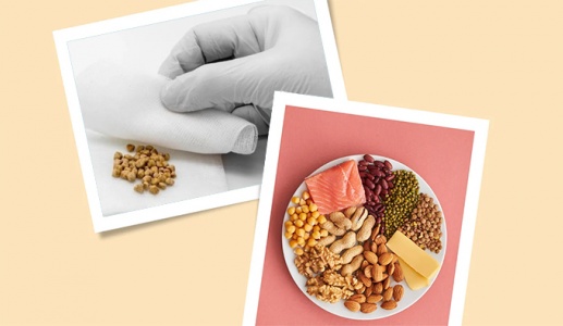 Sỏi cholesterol 18mm cần có chế độ ăn như thế nào?