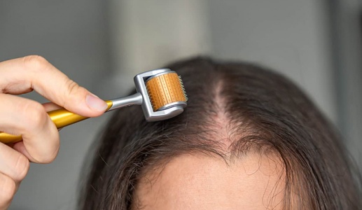 Đột phá công nghệ mở ra hy vọng cho người rụng tóc từng mảng