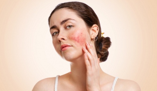 Lupus ban đỏ và ảnh hưởng đến sức khỏe toàn diện