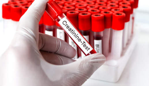 Làm thế nào để ổn định nồng độ creatinine ở bệnh nhân suy thận?