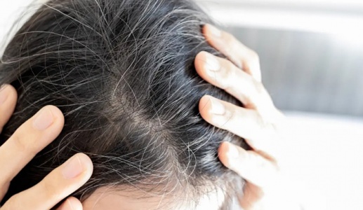 Cách làm chậm quá trình bạc tóc sớm