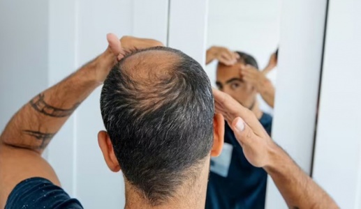 Nam giới bị rụng tóc nên ngừng loại đồ uống nào?