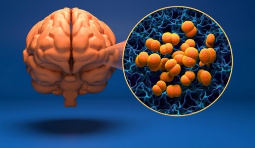 Hà Nội phát hiện ca mắc bệnh não mô cầu thứ 3 trong năm 