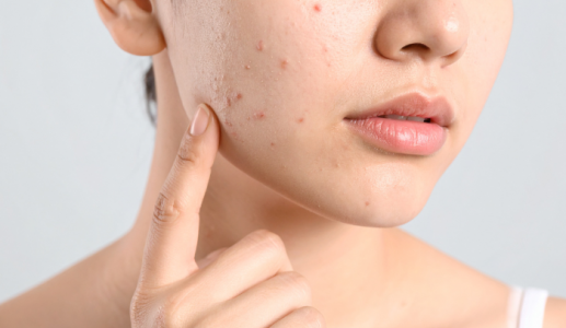 Làm thế nào để da mặt mịn màng khi thời tiết thay đổi?